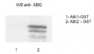 ABI2 | Abscisic acid insensitive 2 in the group Antibodies Plant/Algal / Hormones / Biosynthesis/regulation at Agrisera AB (Antibodies for research) (AS12 1871)